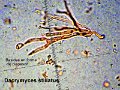Dacrymyces stillatus-amf749-micro